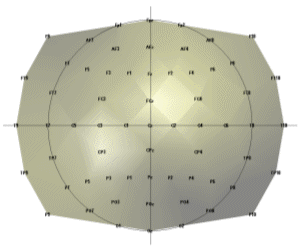  Magnify 